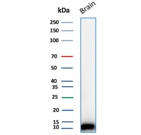 Western blot testing of human brain tissue lysate using S100B antibody (clone 4C4.9). Predicted molecular weight: 12-15 kDa.