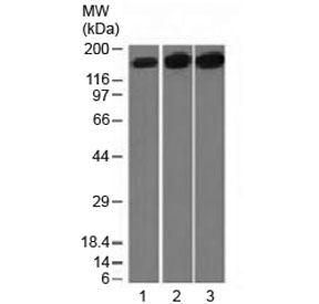 Western blot testing of 1) human HepG2, 2) HeLa and 3) mouse NIH3T3 cell lysate with Topoisomerase II alpha antibody (clone TOP2A/1361). Expected molecular weight ~174 kDa.