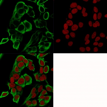 Immunofluorescence testing of human MCF7 cells with recombinant EpCAM antibody (green, clone rMOC-31) and RedDot nuclear stain (red). 