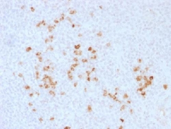 IHC testing of human tonsil and IgG antibody. Required HIER: boil tissue sections in 10mM citrate buffer, pH 6, for 10-20 min followed by cooling at RT for 20 min.