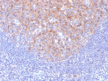 IHC testing of FFPE human tonsil with CD81 antibody (clone 1.3.3.22). Required HIER: boil tissue sections in 10mM citrate buffer, pH 6, for 10-20 min followed by cooling at RT for 20 min.