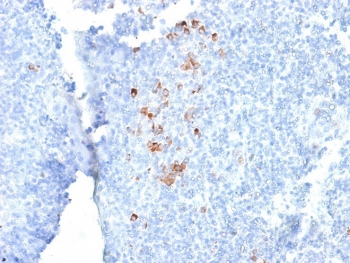 IHC testing of FFPE human tonsil with recombinant human IgG antibody (clone rIG266). Required HIER: boil tissue sections in 10mM citrate buffer, pH 6, for 10-20 min followed by cooling at RT for 20 min.