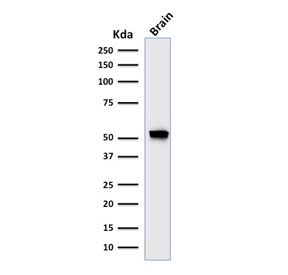 Western blot testing of human brain lysate with recombinant Glial Fibrillary Acidic Protein antibody (clone rASTRO/789). Predicted molecular weight ~50 kDa.