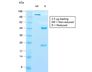 SDS-PAGE analysis of purified, BSA-free recombinant TIMP1 antibody (clone rTIMP1/1710) as confirmation of integrity and purity.