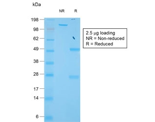 SDS-PAGE analysis of purified, BSA-free recombinant TIMP1 antibody (clone TIMP1/1944) as confirmation of integrity and purity.