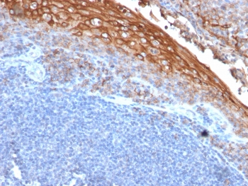 IHC testing of FFPE human tonsil with CD146 antibody (clone rMUC18/1130). Required boiling tissue sections in 10mM Tris with 1mM EDTA, pH8, for 10-20 min followed by cooling at RT for 20 min.