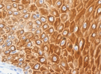 IHC testing of FFPE human skin with recombinant Cytokeratin 16 antibody (clone CTKN16-1R). Required HIER: boil tissue sections in pH6, 10mM citrate buffer, for 10-20 min followed by cooling at RT for 20 min.