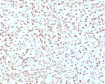 IHC testing of FFPE human pancreas with AKT1 antibody (clone RASTPK-1). HIER: boil tissue sections in pH 9 10mM Tris with 1mM EDTA for 10-20 min followed by cooling at RT for 20 min. 