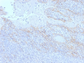 IHC testing of FFPE human tonsil tissue with Beta Catenin antibody (clone CTNNB1/2098). HIER: boil tissue sections in pH6, 10mM citrate buffer, for 10-20 min followed by cooling at RT for 20 min.