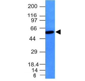 Western blot testing of Vimentin antibody and Raji cell lysate. Expected molecular weight: 53-58 kDa.