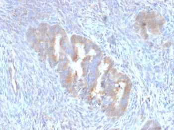 IHC staining of FFPE human endometrium with ATG5 antibody (clone ATG5/2101). Required HIER: boil tissue sections in 10mM citrate buffer, pH 6, for 10-20 min followed by cooling at RT for 20 min.