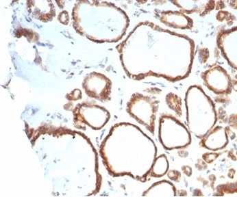 IHC staining of FFPE human thyroid tissue with HSP90AB1 antibody (clone HSP90AB1/4970). HIER: boil tissue sections in pH 9 10mM Tris with 1mM EDTA for 20 min and allow to cool before testing.