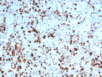 IHC staining of FFPE human placental tissue with S100A4 antibody (clone S100A4/7096). HIER: boil tissue sections in pH 9 10mM Tris with 1mM EDTA for 20 min and allow to cool before testing.