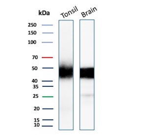 Western blot testing of human tonsil and brain tissue lysate with recombinant PDCD1 antibody. Predicted molecular weight: 32-55 kDa depending on glycosylation level.