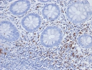 IHC staining of FFPE human colon tissue with S100A4 antibody (clone S100A4/6803). HIER: boil tissue sections in pH 9 10mM Tris with 1mM EDTA for 20 min and allow to cool before testing.