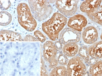 IHC staining of FFPE human kidney tissue with KCNIP2 antibody (clone KCNIP2/7588). Inset: PBS used in place of primary Ab (secondary Ab negative control). HIER: boil tissue sections in pH 9 10mM Tris with 1mM EDTA for 20 min and allow to cool before testing.