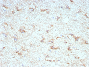 IHC staining of FFPE human cerebellum tissue with KChIP2 antibody (clone KCNIP2/7589). HIER: boil tissue sections in pH 9 10mM Tris with 1mM EDTA for 20 min and allow to cool before testing.