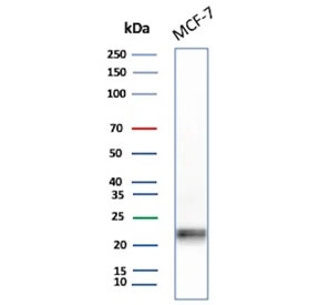 IHC staining of FFPE human tonsil tissue with MGMT antibody (clone MGMT/8319R). Inset: PBS used in place of primary Ab (secondary Ab negative control). HIER: boil tissue sections in pH 9 10mM Tris with 1mM EDTA for 20 min and allow to cool before testing.