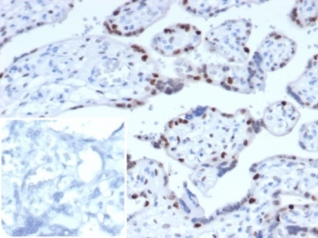 IHC staining of FFPE human placental tissue. Strong nuclear staining observed using KIP2/7187 at 2ug/ml. Inset: PBS used in place of primary Ab (secondary Ab negative control). HIER: boil tissue sections in pH 9 10mM Tris with 1mM EDTA for 20 min and allow to cool before testing.