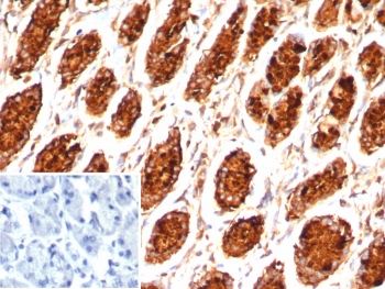 IHC staining of FFPE human stomach tissue with MUC5AC antibody (clone MUC5AC/7798R). Inset: PBS used in place of primary Ab (secondary Ab negative control). HIER: boil tissue sections in pH 9 10mM Tris with 1mM EDTA for 20 min and allow to cool before testing.