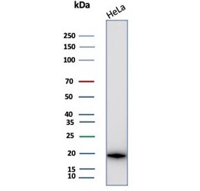 Western blot testing of human HeLa cell lysate with Crystallin Alpha B antibody (clone CRYAB/4659). Predicted molecular weight ~20 kDa.