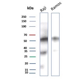 IHC staining of FFPE human lymph node tissue with recombinant CD27 antibody (clone LPFS2/8574R). HIER: boil tissue sections in pH 9 10mM Tris with 1mM EDTA for 20 min and allow to cool before testing.