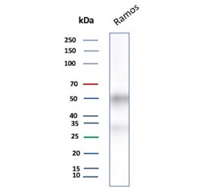 IHC staining of FFPE human tonsil tissue with recombinant CD27 antibody (clone LPFS2/8607R). Inset: PBS used in place of primary Ab (secondary Ab negative control). HIER: boil tissue sections in pH 9 10mM Tris with 1mM EDTA for 20 min and allow to cool before testing.