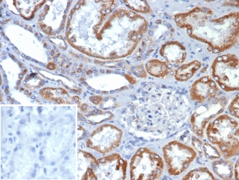 IHC staining of FFPE human kidney tissue with Fibroblast Growth Factor 23 antibody at 2ug/ml. Inset: PBS used in place of primary Ab (secondary Ab negative control). HIER: boil tissue sections in pH 9 10mM Tris with 1mM EDTA for 20 min and allow to cool before testing.