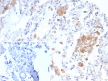 IHC staining of FFPE human lung tissue with Alpha 2 macroglobulin receptor antibody (clone LRP1/6784) Inset: PBS used in place of primary Ab (secondary Ab negative control). HIER: boil tissue sections in pH 9 10mM Tris with 1mM EDTA for 20 min and allow to cool before testing.