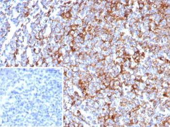 IHC staining of FFPE human tonsil tissue with CD63 antibody (clone rLAMP3/8604). Inset: PBS used in place of primary Ab (secondary Ab negative control). HIER: boil tissue sections in pH 9 10mM Tris with 1mM EDTA for 20 min and allow to cool before testing.