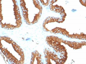 IHC staining of FFPE human tonsil tissue with recombinant LAMP-3 antibody (clone LAMP3/8678R). HIER: boil tissue sections in pH 9 10mM Tris with 1mM EDTA for 20 min and allow to cool before testing.