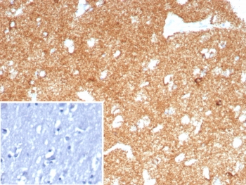 IHC staining of FFPE human brain tissue with recombinant A2MR antibody (clone LRP1/8771R) Inset: PBS used in place of primary Ab (secondary Ab negative control). HIER: boil tissue sections in pH 9 10mM Tris with 1mM EDTA for 20 min and allow to cool before testing.