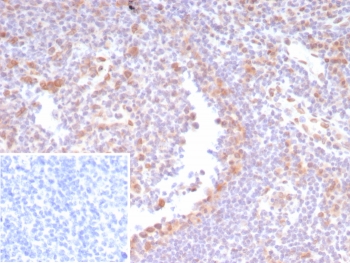 IHC staining of FFPE human tonsil tissue with CDK4 antibody (clone CDK4/8210R). Inset: PBS used in place of primary Ab (secondary Ab negative control). HIER: boil tissue sections in pH 9 10mM Tris with 1mM EDTA for 20 min and allow to cool before testing.