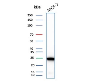 Western blot testing of human MCF7 cell lysate with recombinant LGALS3 antibody (clone rLGALS3/7286). Predicted molecular weight ~26 kDa.
