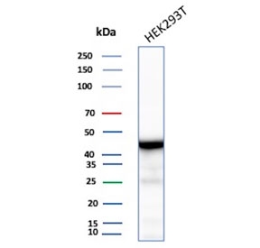 Western blot testing of human HEK293 cell lysate with recombinant CKBB antibody. Predicted molecular weight ~43 kDa.