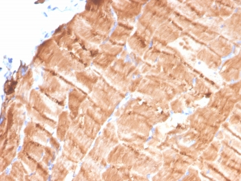 IHC staining of FFPE human skeletal muscle tissue with Tropomyosin antibody (clone TPM1/4510). HIER: boil tissue sections in pH 9 10mM Tris with 1mM EDTA for 20 min and allow to cool before testing.