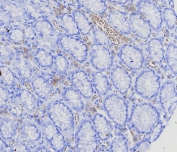 IHC staining of FFPE human stomach (corpus) with BCMA antibody (clone CD269/8125R). HIER: boil tissue sections in pH 9 10mM Tris with 1mM EDTA for 20 min and allow to cool before testing.