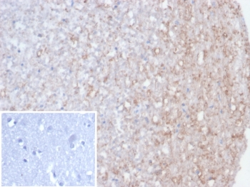 IHC staining of FFPE human brain tissue with recombinant CALB2 antibody (clone rCALB2/7123). Inset: PBS instead of primary (secondary negative control). HIER: boil tissue sections in pH 9 10mM Tris with 1mM EDTA for 20 min and allow to cool before testing.