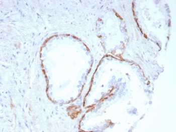IHC staining of FFPE human prostate tissue with KRT14 antibody (clone KRT14/8691R). HIER: boil tissue sections in pH 9 10mM Tris with 1mM EDTA for 20 min and allow to cool before testing.