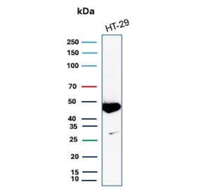 IHC staining of FFPE human colon carcinoma tissue with Cytokeratin 20 antibody (clone KRT20/7805R). HIER: boil tissue sections in pH 9 10mM Tris with 1mM EDTA for 20 min and allow to cool before testing.