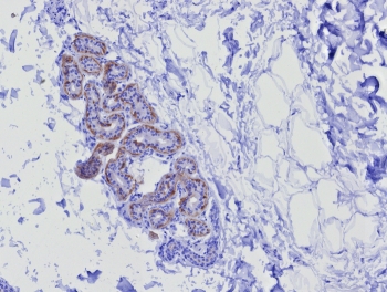 IHC staining of FFPE human skin tissue with recombinant Keratin 17 antibody (clone KRT17/8346R). HIER: boil tissue sections in pH 9 10mM Tris with 1mM EDTA for 20 min and allow to cool before testing.