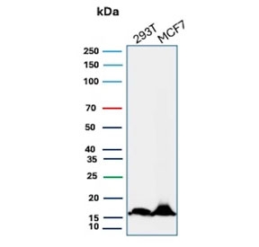 Western blot testing of human 293T and MCF-7 cell lysate with NME2 antibody (clone NME2/4160). Predicted molecular weight ~17 kDa.