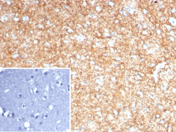 IHC staining of FFPE human brain tissue with GFAP antibody (clone GFAP/8255R). Inset: PBS used in place of primary Ab (secondary Ab negative control). HIER: boil tissue sections in pH 9 10mM Tris with 1mM EDTA for 20 min and allow to cool before testing.