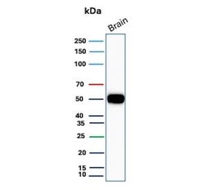 Western blot testing of human brain tissue with GFAP antibody. Predicted molecular weight ~50 kDa.
