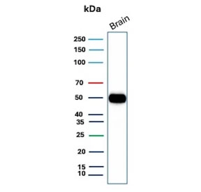 Western blot testing of human brain tissue with GFAP antibody. Predicted molecular weight ~50 kDa.