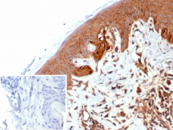 IHC staining of FFPE human skin tissue with Nucleoside diphosphate kinase B antibody (clone NME2/6434). Inset: PBS used in place of primary Ab (secondary Ab negative control). HIER: boil tissue sections in pH 9 10mM Tris with 1mM EDTA for 20 min and allow to cool before testing.