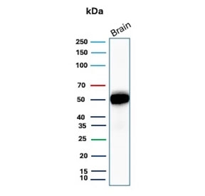 Western blot testing of human brain tissue with GFAP antibody. Predicted molecular weight ~50 kDa.