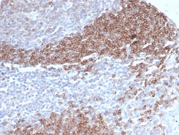 IHC staining of FFPE human tonsil tissue with CD79b antibody (clone CD79b/4960). HIER: boil tissue sections in pH 9 10mM Tris with 1mM EDTA for 20 min and allow to cool before testing.