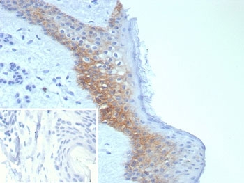 IHC staining of FFPE human skin tissue with Desmoglein-3 antibody (clone DSG3/8252R). Inset: PBS used in place of primary Ab (secondary Ab negative control). HIER: boil tissue sections in pH 9 10mM Tris with 1mM EDTA for 20 min and allow to cool before testing.