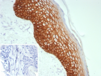 IHC staining of FFPE human skin tissue with Desmoglein 3 antibody (clone DSG3/8613R). Inset: PBS used in place of primary Ab (secondary Ab negative control). HIER: boil tissue sections in pH 9 10mM Tris with 1mM EDTA for 20 min and allow to cool before testing.